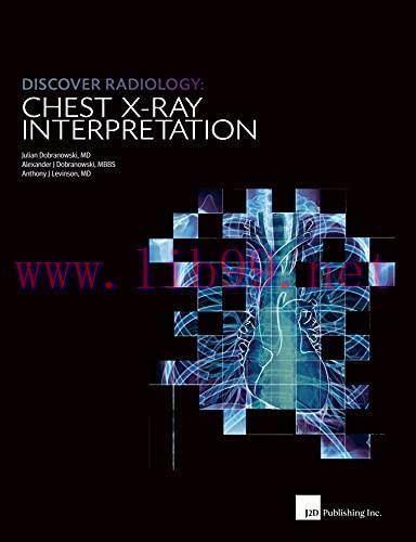 [AME]Discover Radiology Chest X-Ray Interpretation : Book for Medical Student (Original PDF)