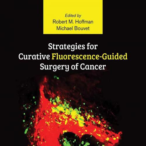 Strategies for Curative Fluorescence-Guided Surgery of Cancer