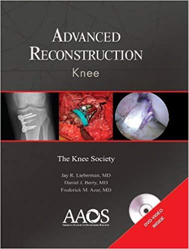 Adcanced Reconstruction - Knee