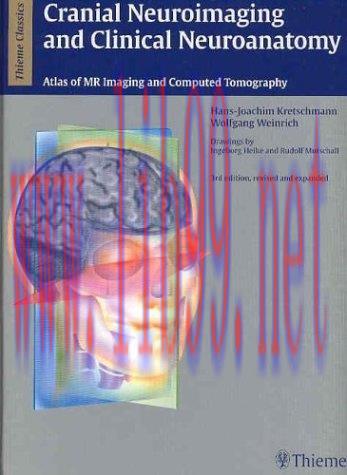 [AME]Cranial Neuroimaging and Clinical Neuroanatomy Magnetic Resonance Imaging and Computed Tom...