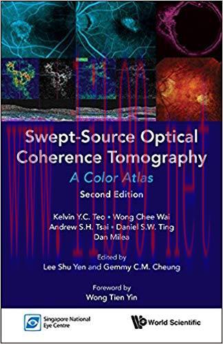[PDF]Swept-Source Optical Coherence Tomography:A Color Atlas 2nd Edition