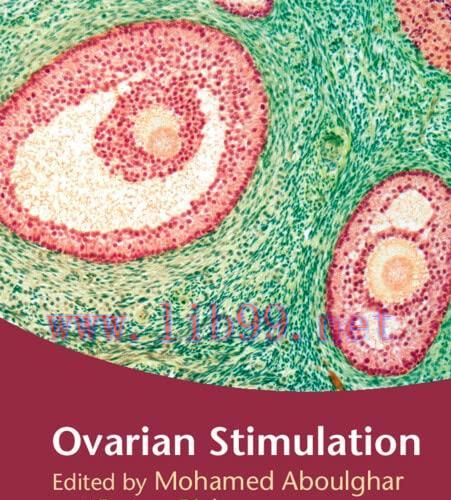 [AME]Ovarian Stimulation, 2nd Edition (Original PDF)