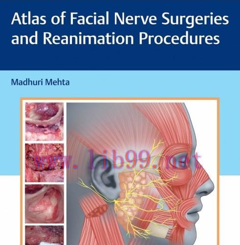 [AME]Atlas of Facial Nerve Surgeries and Reanimation Procedures (Original PDF)
