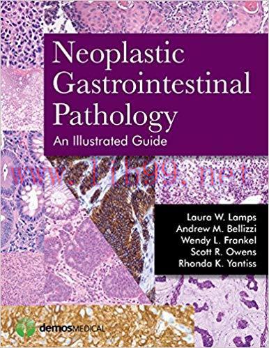 [PDF]Neoplastic Gastrointestinal Pathology