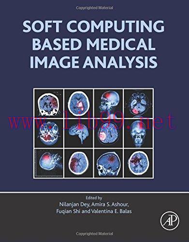 [AME]Soft Computing Based Medical Image Analysis (EPUB)