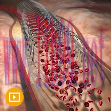 [AME]Comprehensive Review of Interventional Cardiology 2023 (Videos)