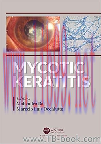 Mycotic Keratitis 1st Edition by Mahendra Rai