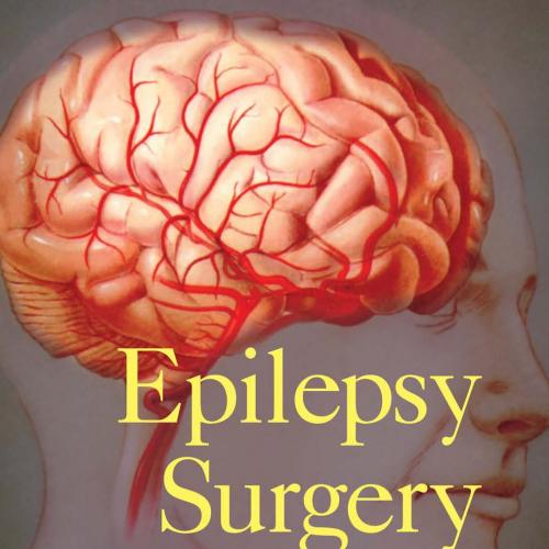 Epilepsy Surgery: Principles and Controversies (Neurological Disease and Therapy) 1st Edition