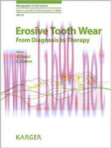 [AME]Erosive Tooth Wear: From_ Diagnosis to Therapy (Monographs in Oral Science, Vol. 25)