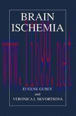 [PDF]Brain Ischemia