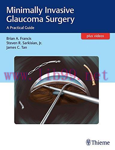 [AME]Minimally Invasive Glaucoma Surgery: A Practical Guide (PDF)