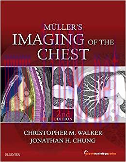 (PDF)Muller&rsquo;s Imaging of the Chest E-Book: Expert Radiology Series