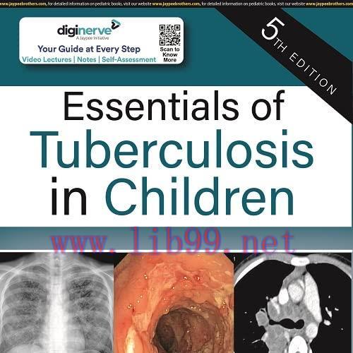 [AME]Essentials of Tuberculosis in Children, 5th Edition (Original PDF)