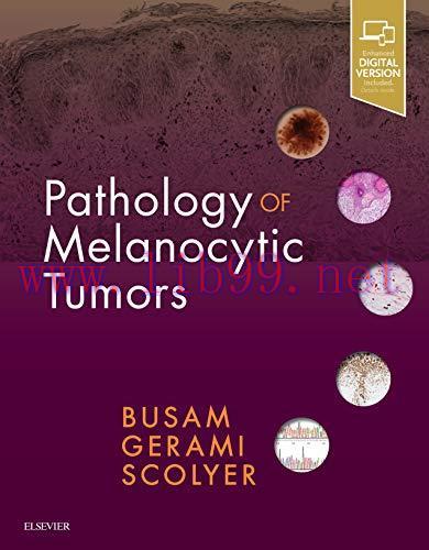[AME]Pathology of Melanocytic Tumors (PDF)