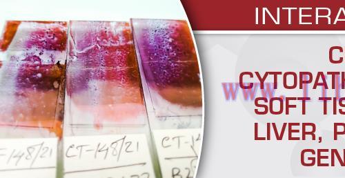 [AME]Crash Course in Cytopathology: Thorax, Soft Tissue, Head and Neck, Liver, Pancreatobiliary...