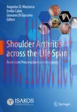 [PDF]Shoulder Arthritis across the Life Span: From_ Joint Preservation to Arthroplasty