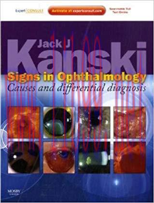 [PDF]Signs in Ophthalmology - Causes and differential diagnosis