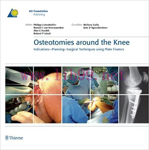 (PDF)Osteotomies around the Knee: Indications-Planning-Surgical Techniques using Plate Fixators...