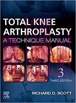 (PDF)Total Knee Arthroplasty E-Book 3rd Edition