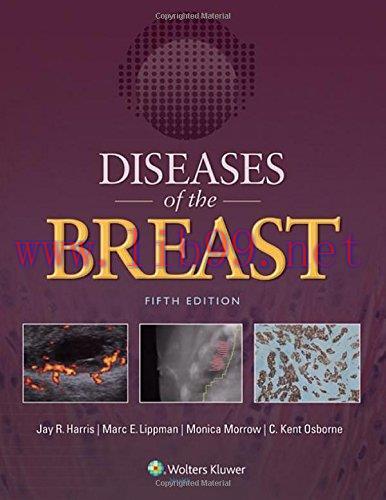 [AME]Diseases of the Breast, 5th Edition (EPUB)