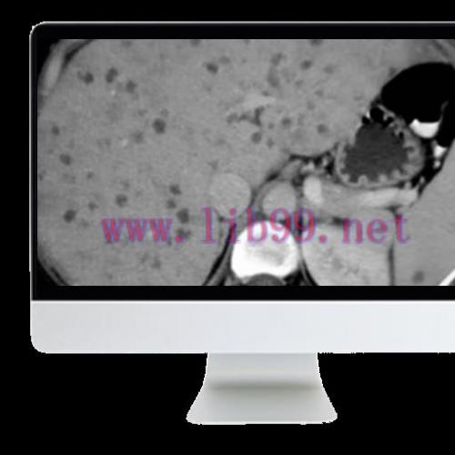 [AME]State of the Art Imaging for Chronic Liver Disease 2021 (CME VIDEOS)