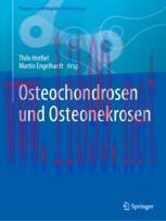 [PDF]Osteochondrosen und Osteonekrosen
