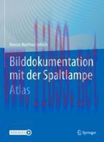 [PDF]Bilddokumentation mit der Spaltlampe: Atlas
