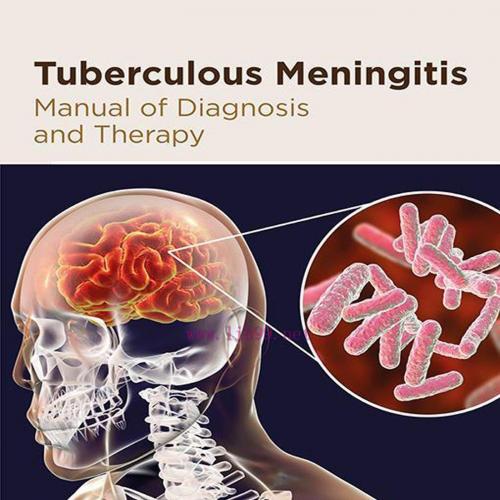 [AME]Tuberculous Meningitis: Manual of Diagnosis and Therapy (EPUB)