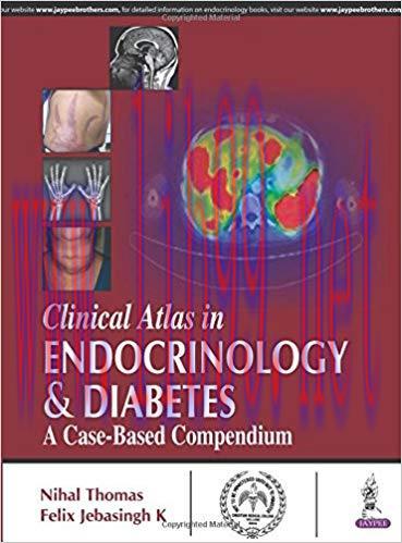 [PDF]Clinical Atlas in Endocrinology and Diabetes