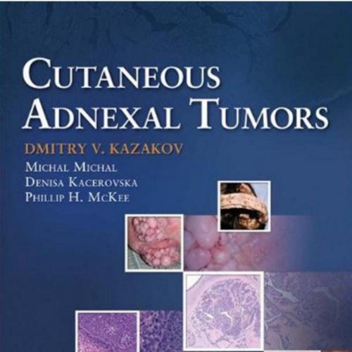 Cutaneous Adnexal Tumors