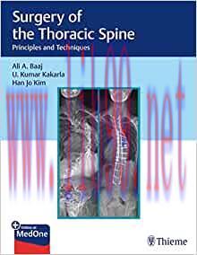 [AME]Surgery of the Thoracic Spine: Principles and Techniques (EPUB)