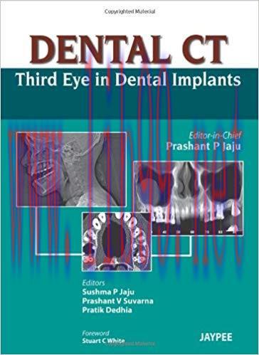 [PDF]Dental CT - Third Eye in Dental Implants