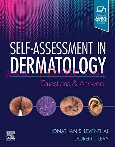 [AME]Self-Assessment in Dermatology: Questions and Answers (EPUB)