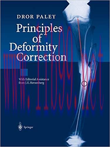 [AME]Principles of Deformity Correction (Original PDF)