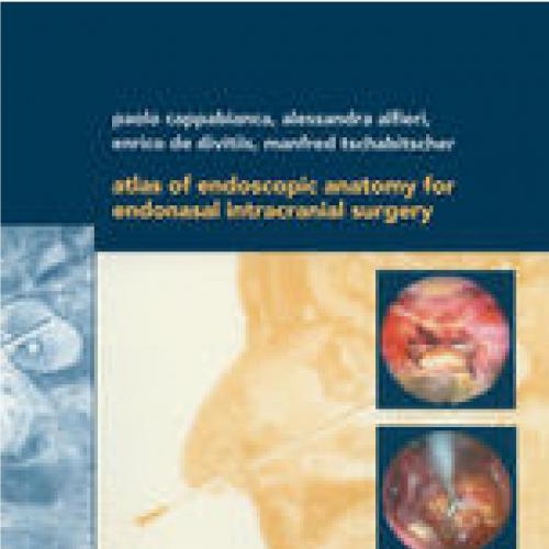 Atlas of Endoscopic Anatomy for Endonasal Intracranial Surgery - Wei Zhi