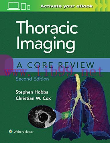 [AME]Thoracic Imaging: A Core Review, 2nd edition (ePub+Converted PDF)