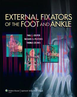 [AME]External Fixators of the Foot and Ankle (ORIGINAL PDF from_ Publisher)