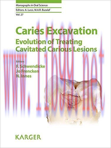 [AME]Caries Excavation: Evolution of Treating Cavitated Carious Lesions (Monographs in Oral Sci...