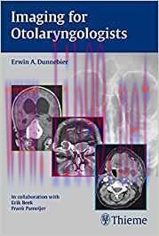 [PDF]Imaging for Otolaryngologists