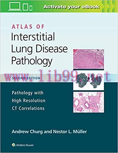 [Html]Atlas of Interstitial Lung Disease Pathology 2nd Edition