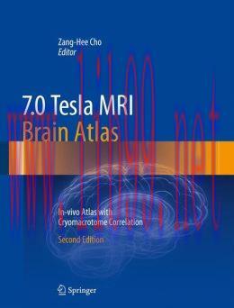 [AME]7.0 Tesla MRI Brain Atlas: In-vivo Atlas with Cryomacrotome Correlation