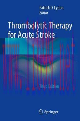 [AME]Thrombolytic Therapy for Acute Stroke