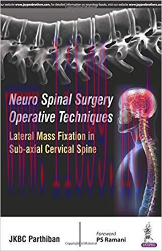 [PDF]Neuro Spinal Surgery Operative Techniques Lateral Mass Fixation in Sub-axial Cervical Spin...