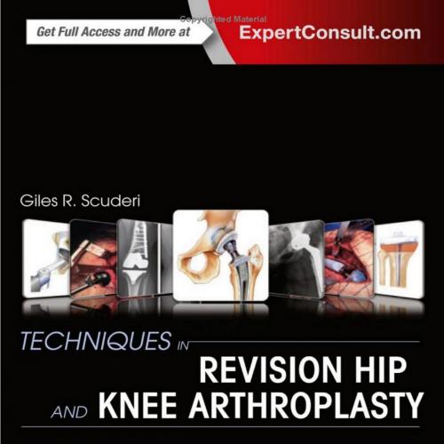 Techniques in Revision Hip and Knee Arthroplasty