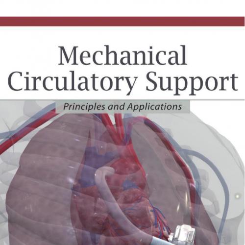 Mechanical Circulatory Support-Principles and Applications