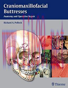 [PDF]Craniomaxillofacial Buttresses