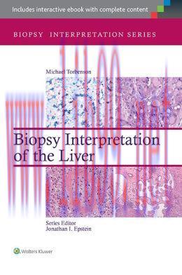 [AME]Biopsy Interpretation of the Liver (ORIGINAL PDF from_ Publisher)