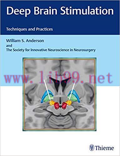 (PDF)Deep Brain Stimulation: Techniques and Practices 1st Edition