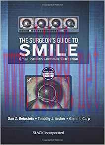 [PDF]The Surgeon’s Guide to SMILE