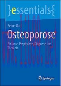 [AME]Osteoporose: Biologie, Prophylaxe, Diagnose und Therapie (essentials) (German Edition) (Or...